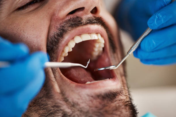 Best Urgent Tooth Repair  in Cornelius, NC