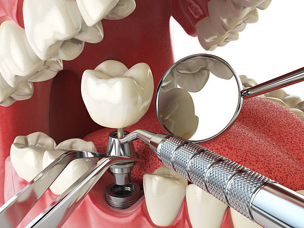 Best Tooth Infection Emergency Dentist  in Cornelius, NC