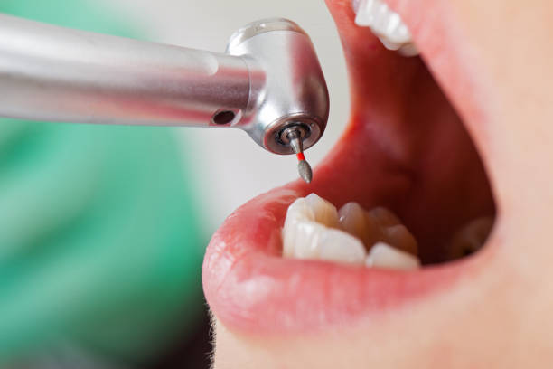 Best Root Canal Emergency Dentist  in Cornelius, NC